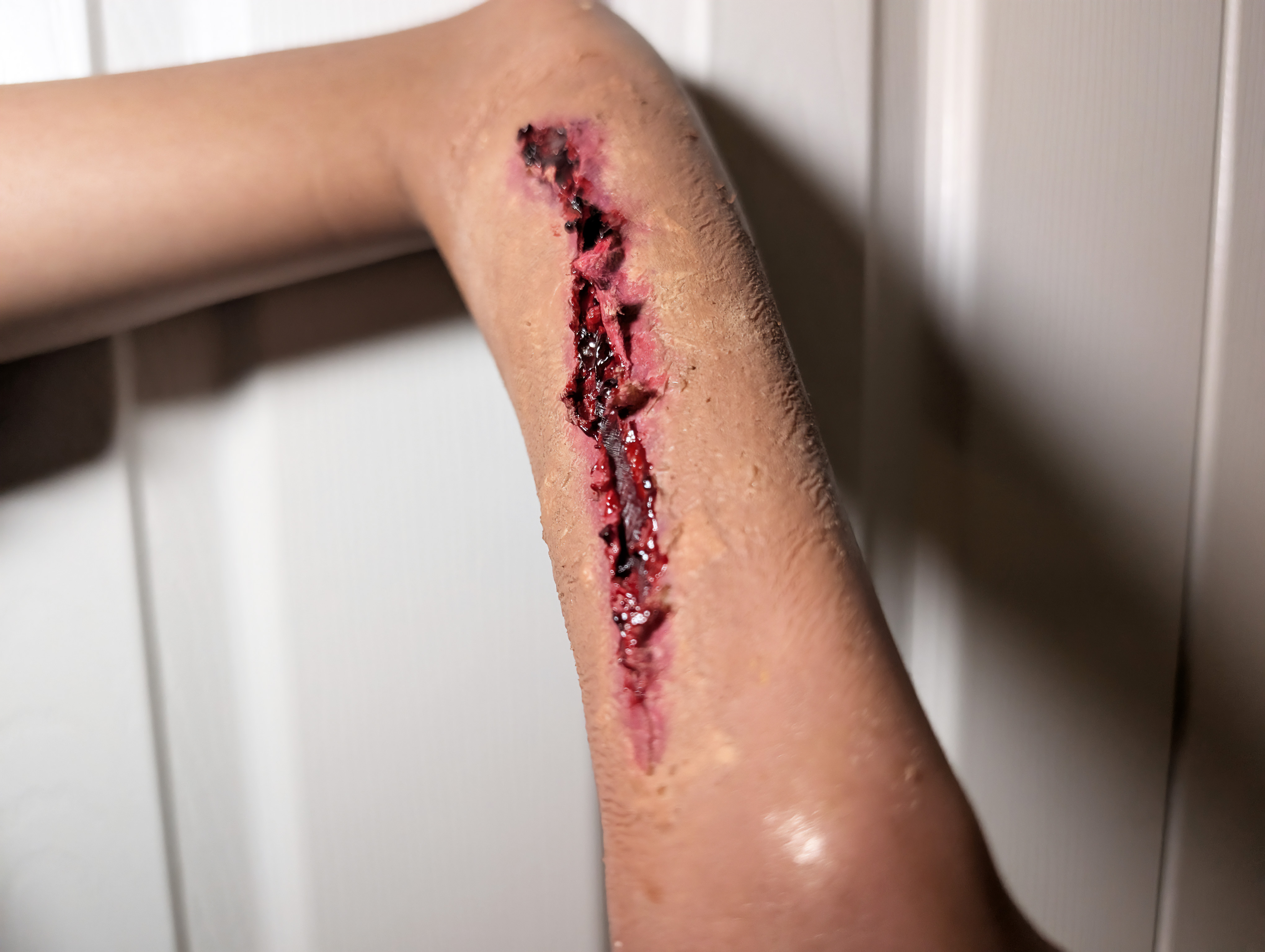 Youth SFX makeup showing blunt-force trauma and arm laceration